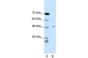 CACNB4 antibody used at 1 ug/ml to detect target protein. (CACNB4 抗体  (C-Term))