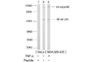 Image no. 2 for anti-Nuclear Factor of kappa Light Polypeptide Gene Enhancer in B-Cells 2 (NFKB2) (AA 868-872) antibody (ABIN197120) (NFKB2 抗体  (AA 868-872))