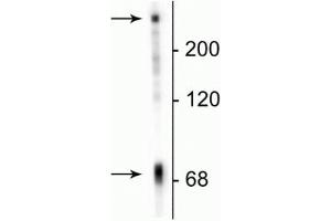 Western blot of neonatal rat brain lysate showing specific immunolabeling of the ~70 kDa MAP2C/D protein.
