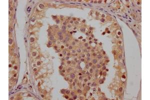 Immunohistochemistry (IHC) image for anti-Chloride Channel, Voltage-Sensitive 6 (CLCN6) (AA 572-869) antibody (ABIN7147591)