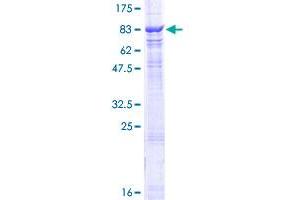 CHAF1B Protein (AA 1-559) (GST tag)