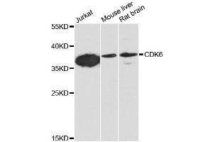 Western blot analysis of extracts of various cell lines, using CDK6 antibody. (CDK6 抗体)