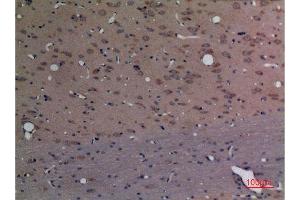 Immunohistochemistry (IHC) analysis of paraffin-embedded Rat Brain, antibody was diluted at 1:100. (CPE 抗体  (C-Term))