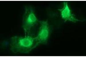 Image no. 3 for anti-Fc Fragment of IgG, High Affinity Ia, Receptor (CD64) (FCGR1A) antibody (ABIN1497349) (FCGR1A 抗体)