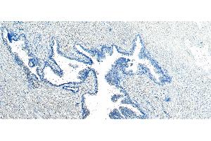 Immunohistochemistry (IHC) image for anti-Vacuolar Protein Sorting 35 (VPS35) (C-Term) antibody (ABIN185182)