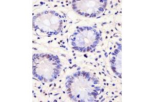 Immunohistochemistry (Paraffin-embedded Sections) (IHC (p)) image for anti-Proline-, Glutamic Acid- and Leucine-Rich Protein 1 (PELP1) (AA 744-771) antibody (ABIN655815)
