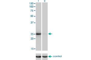 Western blot analysis of THAP1 over-expressed 293 cell line, cotransfected with THAP1 Validated Chimera RNAi (Lane 2) or non-transfected control (Lane 1). (THAP1 抗体  (AA 1-213))