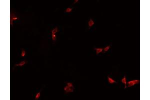 ABIN6266867 staining HeLa  cells by IF/ICC. (HEXIM1 抗体)