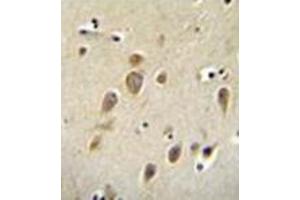 Immunohistochemistry (Paraffin-embedded Sections) (IHC (p)) image for anti-Arginyl-tRNA Synthetase (RARS) (AA 612-642), (C-Term) antibody (ABIN954456)