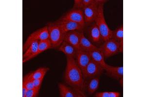 IF analysis of RANBP1 using anti-RANBP1 antibody (ABIN7602058). (RANBP1 抗体  (AA 57-194))