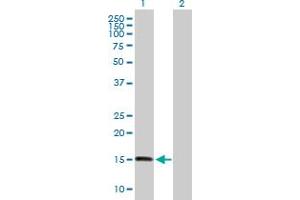 Western Blotting (WB) image for anti-Zinc Finger, HIT-Type Containing 1 (ZNHIT1) (AA 1-154) antibody (ABIN523875)