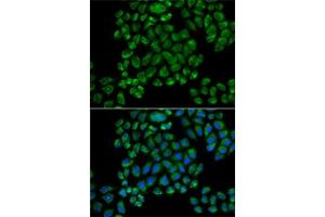 Immunofluorescence analysis of HeLa cells using GRI antibody (ABIN6127964, ABIN6141386, ABIN6141387 and ABIN6218189). (Glutamate Receptor 3 抗体  (AA 200-490))