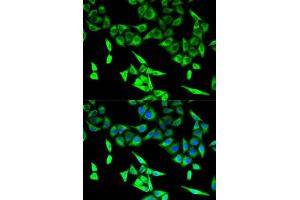 Immunofluorescence analysis of U2OS cells using HADHA antibody. (HADHA 抗体  (AA 484-763))