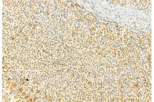 ABIN6259235 and ABIN6274259 at 1/100 staining Rat stomach tissue by IHC-P. (YAP1 抗体  (Internal Region))
