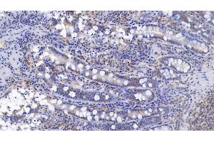 Immunohistochemistry (IHC) image for anti-Complement Component Receptor 1 (CD35) (CR1) (AA 1780-2039) antibody (ABIN7433177)