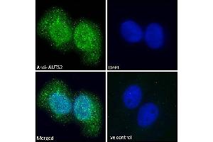 ABIN308459 Immunofluorescence analysis of paraformaldehyde fixed U2OS cells, permeabilized with 0. (AUTS2 抗体  (C-Term))