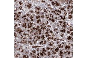Immunohistochemical staining of human pancreas with C11orf80 polyclonal antibody  shows strong granular cytoplasmic positivity in exocrine glandular cells at 1:10-1:20 dilution. (C11ORF80 抗体)