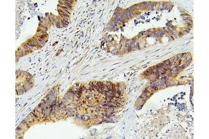 IHC analysis of SMARCAD1 using anti-SMARCAD1 antibody (ABIN6719539).