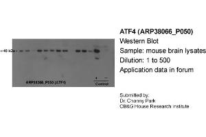 Western Blotting (WB) image for anti-Activating Transcription Factor 4 (Tax-Responsive Enhancer Element B67) (ATF4) (N-Term) antibody (ABIN2780377) (ATF4 抗体  (N-Term))