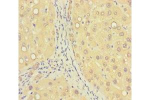 Immunohistochemistry of paraffin-embedded human liver tissue using ABIN7176405 at dilution of 1:100 (ZNF583 抗体  (AA 1-300))