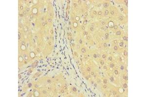 Immunohistochemistry of paraffin-embedded human liver tissue using ABIN7176405 at dilution of 1:100 (ZNF583 抗体  (AA 1-300))