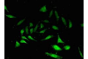 Immunofluorescent analysis of Hela cells using ABIN7161039 at dilution of 1:100 and Alexa Fluor 488-congugated AffiniPure Goat Anti-Rabbit IgG(H+L) (NANOS3 抗体  (AA 21-192))