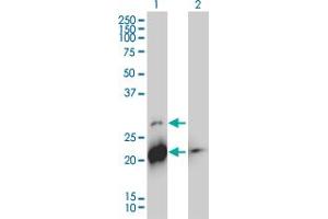 Western Blot analysis of BID expression in transfected 293T cell line by BID monoclonal antibody (M01), clone 3F3-1A3. (BID 抗体  (AA 1-195))