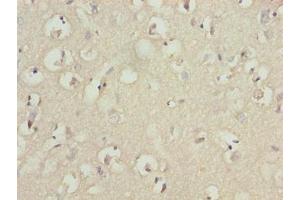 Immunohistochemistry of paraffin-embedded human brain tissue using ABIN7173675 at dilution of 1:100 (TUBB1 抗体  (AA 270-451))