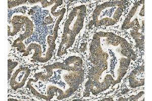 IHC analysis of FABP6 using anti-FABP6 antibody (ABIN7598974). (FABP6 抗体  (AA 1-128))