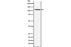 Western blot analysis of Ionotropic Glutamate receptor 4 expression in SH-SY5Y cell lysate.