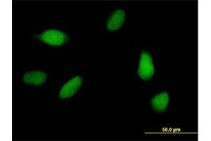 Immunofluorescence (IF) image for anti-PDS5, Regulator of Cohesion Maintenance, Homolog A (PDS5A) (AA 1-333) antibody (ABIN525050)