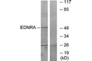 Western blot analysis of extracts from HepG2 cells, using EDNRA Antibody. (Endothelin-1 Receptor 抗体  (AA 378-427))