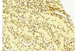 ABIN6276285 at 1/100 staining Mouse liver tissue by IHC-P.