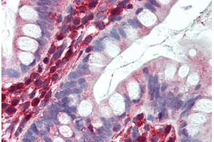 Small intestine, Human: Formalin-Fixed, Paraffin-Embedded (FFPE) (LDHB 抗体  (C-Term))