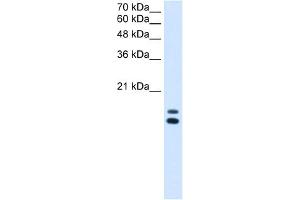 WB Suggested Anti-UXT Antibody Titration:  2. (UXT 抗体  (N-Term))