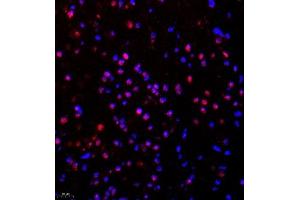 Immunofluorescence of paraffin embedded mouse brain using SR140 (ABIN7076091) at dilution of 1:600 (400x lens) (SR140 抗体)