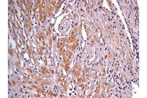 Immunohistochemistry (IHC) image for anti-Isocitrate Dehydrogenase 1 (NADP+), Soluble (IDH1) (Center) antibody (ABIN2856056)