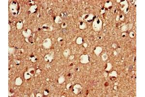 Immunohistochemistry of paraffin-embedded human brain tissue using ABIN7150991 at dilution of 1:100 (RNF4 抗体  (AA 471-724))