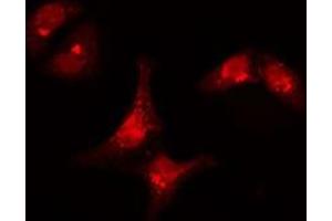 ABIN6277308 staining  Hela cells by IF/ICC. (KRT15 抗体  (N-Term))