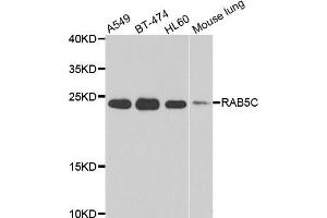 Western blot analysis of extracts of various cell lines, using RAB5C antibody (ABIN5975504) at 1/1000 dilution. (Rab5c 抗体)