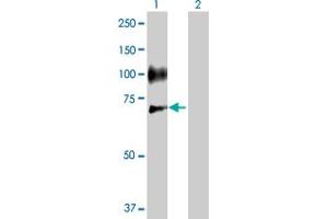 Western Blot analysis of SELE expression in transfected 293T cell line by SELE MaxPab polyclonal antibody. (Selectin E/CD62e 抗体  (AA 1-610))