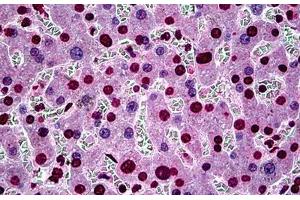 Human Liver: Formalin-Fixed, Paraffin-Embedded (FFPE) (SGK1 抗体  (AA 1-91))