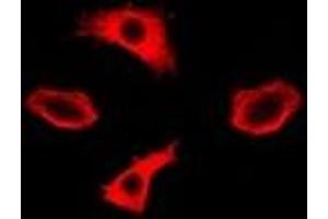 Immunofluorescent analysis of IMPA1 staining in A549 cells. (IMPA1 抗体)