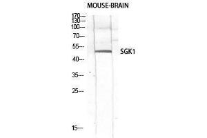 Western Blotting (WB) image for anti-serum/glucocorticoid Regulated Kinase 1 (SGK1) (Tyr1062) antibody (ABIN3186931) (SGK1 抗体  (Tyr1062))