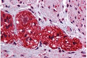 Human Colon, Myenteric Plexus: Formalin-Fixed, Paraffin-Embedded (FFPE) (SOX6 抗体  (C-Term))