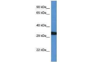 WB Suggested Anti-GFRA4 AntibodyTitration: 1. (GFRA4 抗体  (C-Term))