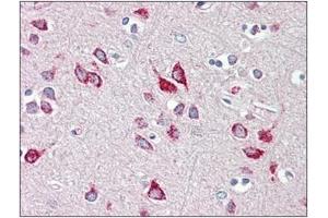 Human Brain, Cortex: Formalin-Fixed, Paraffin-Embedded (FFPE) (HEXB 抗体  (C-Term))