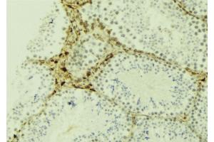 ABIN6274469 at 1/100 staining Mouse testis tissue by IHC-P. (JAKMIP2 抗体  (C-Term))