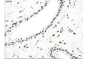 Immunohistochemical staining of paraffin-embedded breast tissue using anti-MAP2K4 mouse monoclonal antibody. (MAP2K4 抗体)