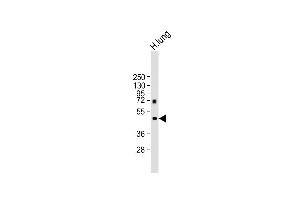 Anti-P12 Antibody at 1:1000 dilution + human lung lysate Lysates/proteins at 20 μg per lane.